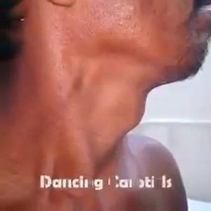 SEGNO DI CORRIGAN L'ampia pulsazione carotidea a livello del collo è definita "segno di Corrigan" e rappresenta uno dei segni rilevabili in caso di insufficienza aortica. Per Insufficienza aortica o rigurgito aortico si intende il manifestarsi del reflusso di sangue dall'aorta nel ventricolo sinistro in diastole, dovuto ad un'anomalia che determina un'imperfetta chiusura della valvola aortica, totale o parziale. Ciò comporta che il ventricolo sinistro si trovi in sovraccarico di volume per l'ing