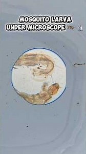 Mosquito Culex Larva under Microscope 🦟 🔬