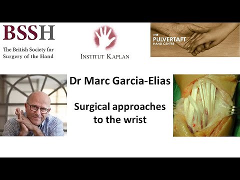 Surgical approaches to the wrist by Dr Marc Garcia Elias
