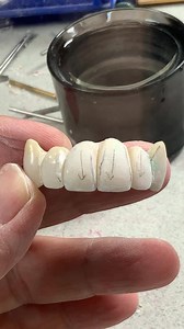 10K views · 108 reactions | How to go from ugly to beautiful restorations! Here is a master class in contouring PFMs. This is a case I'm using to train my employee. Hope you enjoy, and check out more like this on my YouTube channel LSK121! www.youtube.com/LSK121 | LSK121 Oral Prosthetics | Facebook