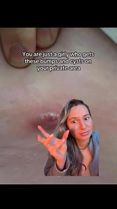 Universal Flare Care’s versatility is unmatched—tackles everything from itchy spots to cracked skin in one swoop. #skinissues #mymagichealer #cysts #fyp #viral | Mymagichealer