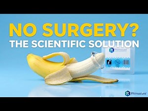 How Phimosis Rings Work – The Science Explained