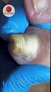 1000. Diet shifts and “adrenal fatigue”: context and cautions #BalancedNutrition #BalancedLiving #EnergyBalance | Bye