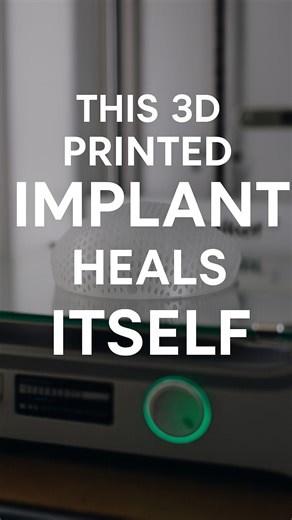 A 3D printed implant that heals itself ✨ Developed in France by @latticemedical , this breakthrough technology helps women regrow natural breast tissue after cancer. It isn’t just medicine. It’s hope, printed layer by layer 💗 | 3Dnatives