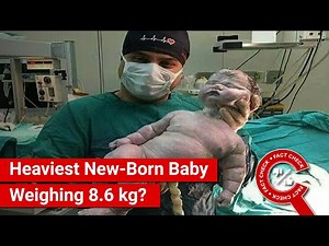 FACT CHECK: Viral Photo Shows Heaviest New-Born Baby Weighing 8.6 kg?