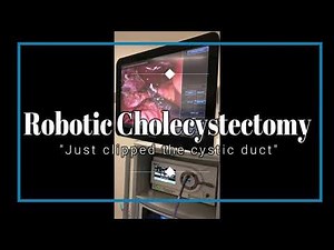 Robotic Cholecystectomy by Dr. Iraniha