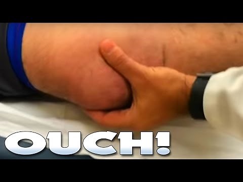 dislocated knee or patella