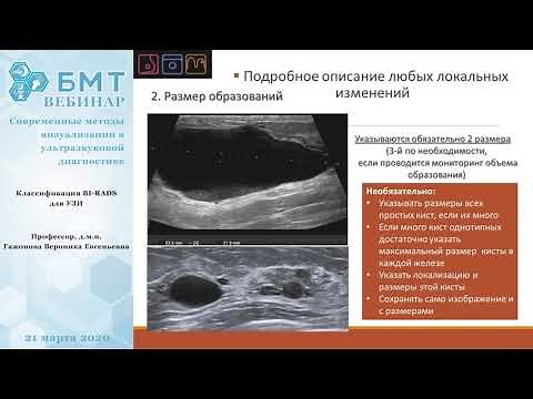 Классификация BI-RADS для УЗИ