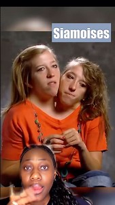 Les jumeaux siamois, Boyaka eza Nini ndeko #congo #kinshasa🇨🇩 #mamafitrise | Laetitia Ankoum Muana Ngani