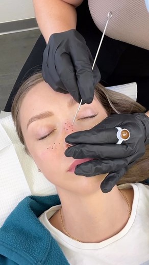 62K views · 77 reactions | The one where @inkbychlo gives me Faux Freckles  I love freckles and have always wished I had a little more, good thing my sister knows how to tattoo them on hehehe! | Cosmobyhaley | Facebook