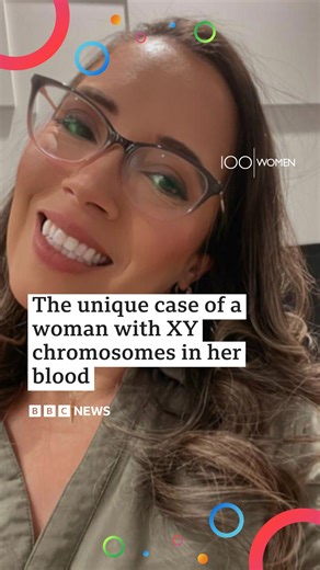 This Brazilian woman made a shocking discovery three years ago. In every other cell of her body, Ana Paula Martins has XX chromosomes - related to female sexual characteristics. But in her blood cells, she carries XY chromosomes - typically belonging to males. Doctors think her blood originated from her twin brother while they were both still in the womb. This very rare case has caught the attention of doctors and geneticists. The discovery came in 2022 after Ana Paula suffered a miscarriage and