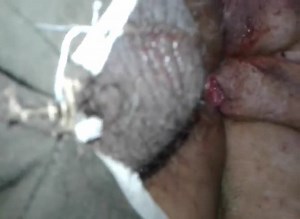 culito atorado (Nudo de Perro)