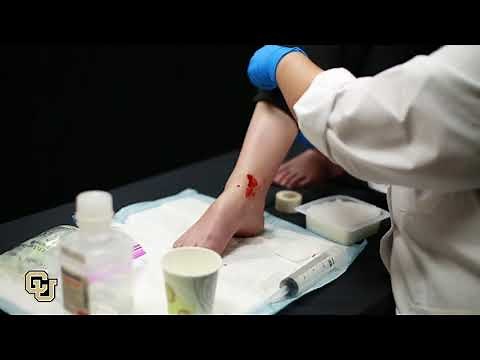How to treat a snake bite wound
