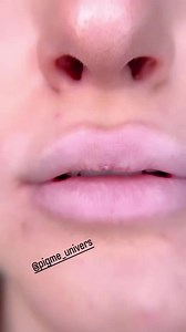 Correction, rafraîchissement, défloutage, voilage, neutralisation, repulpement léger, coloration superficielle, effet naturel et semi-permanent mais durable, tout cela et j’en passe... découvrez notre ultime technique le LIPBLUSH pour des lèvres 👄 sexy et classe ! Infos line Whatsapp 📞00216.25.935.876🎉 NOUVEAUTÉ spéciale pigme univers]]🎉 Le LIPBLUSH, cette technique révolutionnaire, notre nouvelle et propre méthode avancée de maquillage semi-permanent des lèvres développée par p