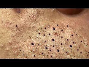 Enjoy Your Day With Hien Nguyen Spa # 1203