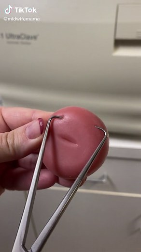 Tenaculum helps me hold the cervix when I place an IUD #midwifemama