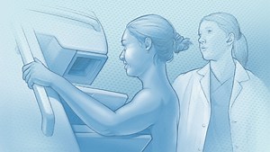 JAMA | Screening for Breast Cancer