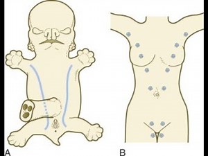 DEVELOPMENT OF THE SKIN AND ITS APPENDAGES—CONGENITAL ANOMALIES