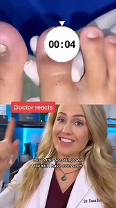 400K views · 2.1K reactions | An extreme ingrown toenail with skin...