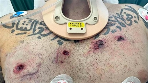 Punisher’s next fight after ‘miracle’ survival