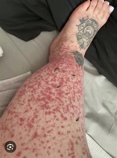 ‼️These are the consequences of sleeping with…See more | HT Lifestyle
