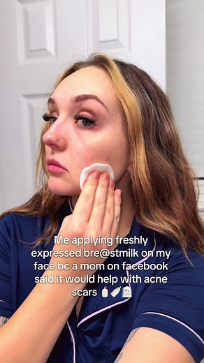 Using Breast Milk for Skincare: A New Mom's Journey