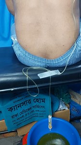 255K views · 2.1K reactions | Pleural Effusion Main Causes Tb,...