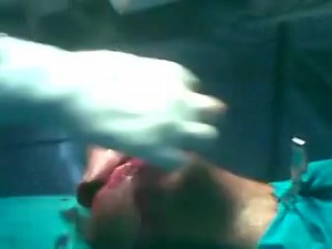 K Wire Fixation