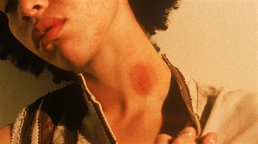 Six ways to get rid of a hickey that actually work — and two that don't - video Dailymotion