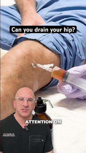 How Do You Drain a Swollen Hip? Hip Aspiration Basics