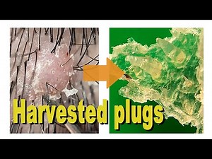 No.152 Harvested plugs