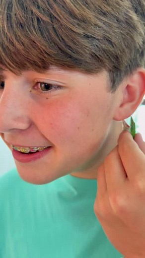 OWW! Lizard Bit My Ear!🦎👂 #lizards #bite #letgo | borillasnaps
