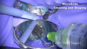 MicroEndo. Cleaning and shaping at low-middle step microscope magnification. Controlling details during all the steps of the endodontic treatment while we are well positioned and in a neutral work posture matters. #amed #advanceddentalergonomics #microscopedentistry #microendo | AMED - Academy of Microscope Enhanced Dentistry