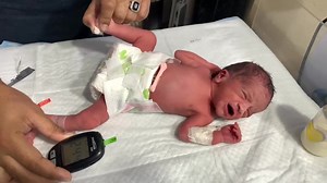 19K views · 500 reactions | Cute Baby With Low RBS  | Poor Suck Present | Does High or Low RBS Affect Baby Health? #viral #baby | Anoop Gautam | Facebook