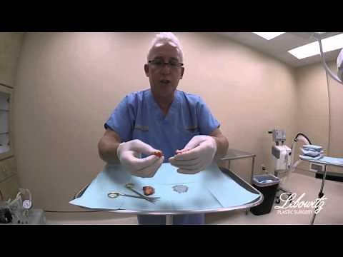 Examination of Gynecomastia (Male Breast) Gland Excision at Lebowitz Plastic Surgery