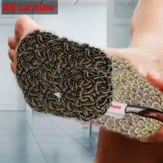 Treatment of foot infection and rest from a doctor ✅✅ #asmrviral #viralshorts2025 #reelsvideoシ #viralasmr #relaxation | Md Lal Asmr