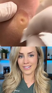 Great job! But what is with this music 😆 VC #callus #callusshaving #footdoctor #calluses | Footdocdana