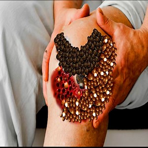 41K views · 285 reactions | Knee Treatment Infected Dog ticks & Maggots | Lline Theodora | Facebook