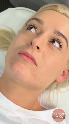 A little behind-the-scenes of the Lip Blush Tattooing process! We used premium-quality pigments and top-of-the-line numbing products to ensure a smooth, comfortable experience from start to finish. My lovely client was relaxed the entire time — she even said it was completely painless! Lip blush is perfect for enhancing your natural lip tone, correcting asymmetry, and giving you that effortless flush of colour every day. If you’ve been thinking about it… this is your sign! @toochi_pmu numbing sh