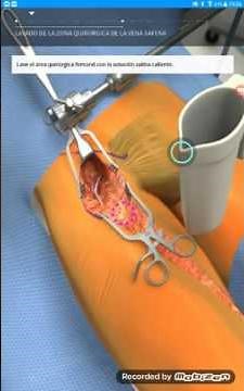 VASCULAR, Bypass femoral. FASE 6/6: Cierre