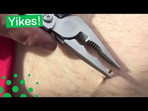 SKATEBOARDER REMOVES LARGE SPLINTER FROM LEG