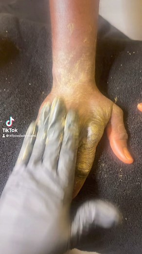 2.5K views · 22 reactions | Moun ki gen problem pied 禮 de couleur yo main plusieurs couleurs mwen gen solution pou sa | Estavenia L Gilles | Facebook