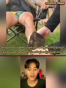 29K views · 377 reactions | မာရသွန်ပြေးပွဲမှာ ခြေအိပ်မလဲ နားလည်းမနားဘဲ ပြေးရင် ခြေထောက်ဒီလိုဖြစ်သွားနိုင်တယ် ... | Creative Vlogs | Facebook