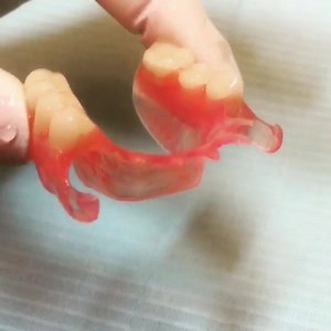 Who said dentures were uncomfortable We Love Valplast flexible...