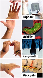 2.9M views · 12K reactions | Acupressure points ✅ #yoga #acupressurepoints #acupressuremat #hairgrowthtips #hairgrowth #stressrelief #AcidityRelief #acidity #viralreels #trendingreels2025 #YogaDay2025 #usa #canada | Vedicyoga with Shivam | Facebook