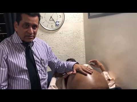 FLUID THRILL IN TENSE ASCITES