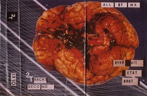Two Tracks - Second