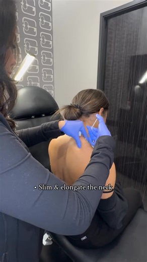 Trap Tox (Botox in the trapezius muscles) is a highly effective treatment designed to relax overactive shoulder muscles — and the benefits go beyond aesthetics. Why clients love it: • Eases chronic neck and shoulder tension • Improves posture and range of motion • Creates a longer, more refined neckline • Softens the appearance of bulky or tense shoulders Ideal for those experiencing muscle tightness, migraines, or looking to enhance their profile with subtle sculpting. Treatment by @angel_secre