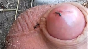 ant bites peehole torture 2
