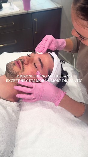 Microneedling Experience: My Husband's Dramatic Reaction